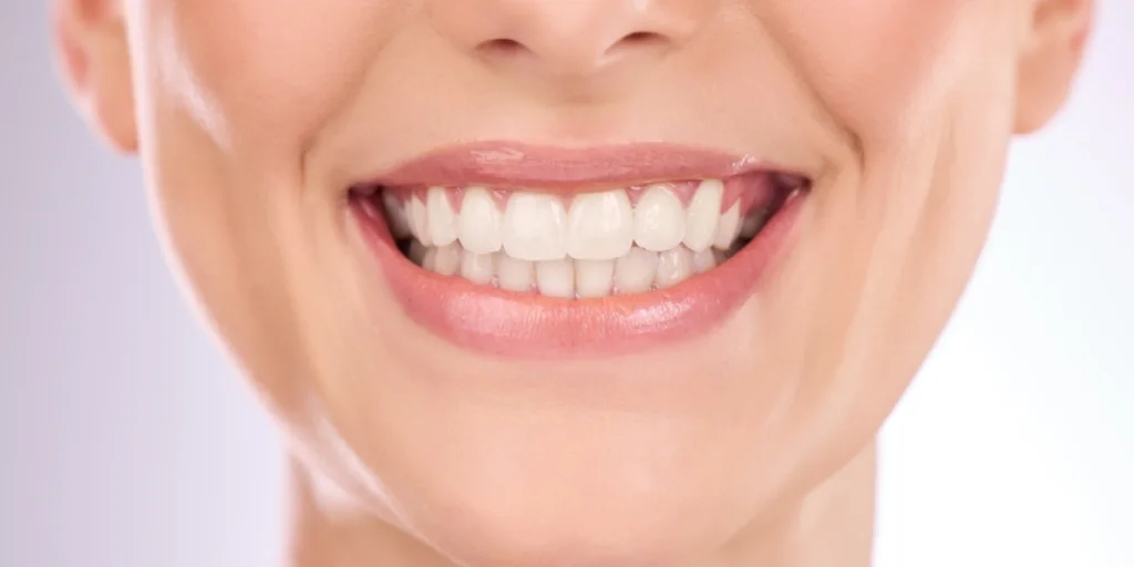 The-Key-Benefits-of-Professional-Teeth-Whitening