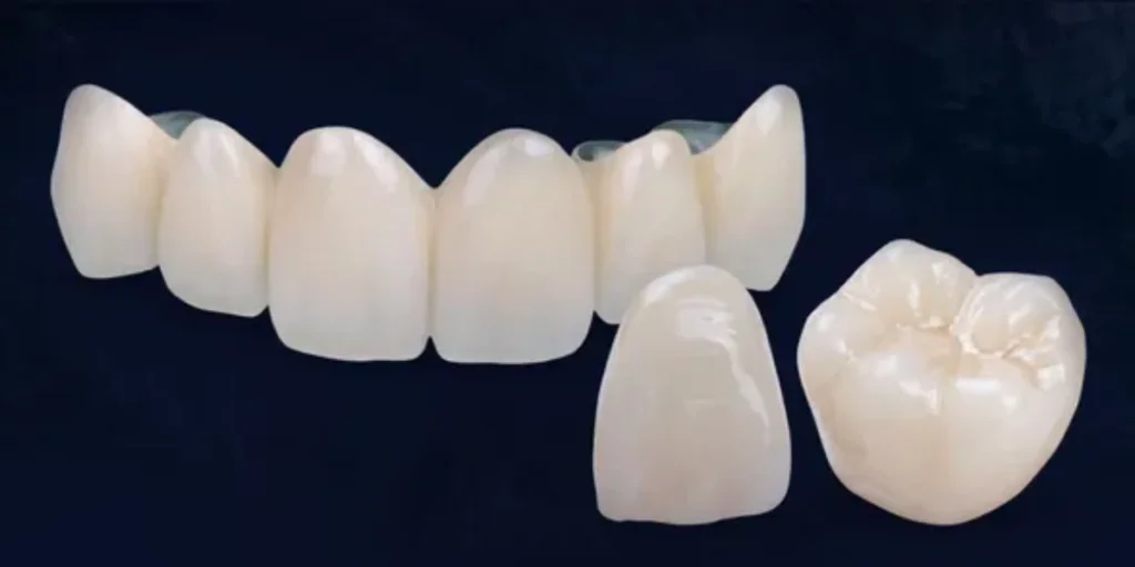 Are-Crowns-and-Bridges-Right-for-You