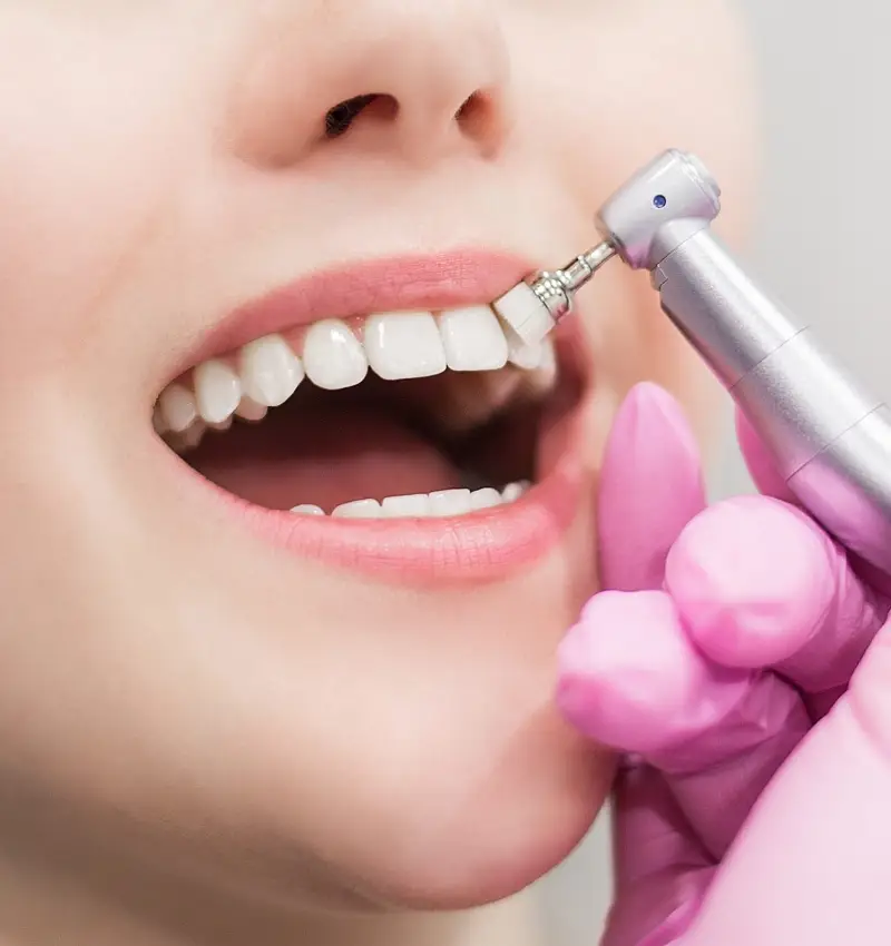 Best Teeth Cleaning in Abu Dhabi
