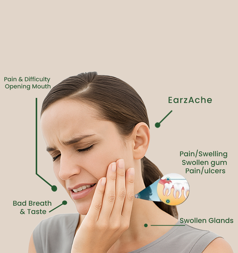 Wisdom Tooth Removal in Abu Dhabi