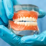 What Are Dentures Types, Care & Benefits