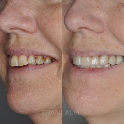 WhatsApp Image 2025-07-02 at 1.16.45 PM-4